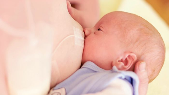 Medela Supplemental Nursing System (SNS)